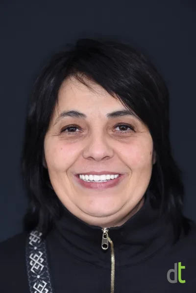 Portrait and smile after the complex treatment